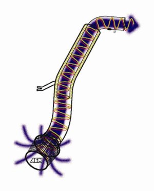 Honda Prelude Performance Air Intake - AEM Induction - Dual Chamber - Gunmetal Gray - `92-`01